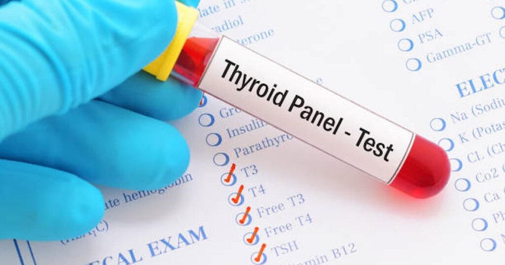 Thyroid Test Market Harborough 