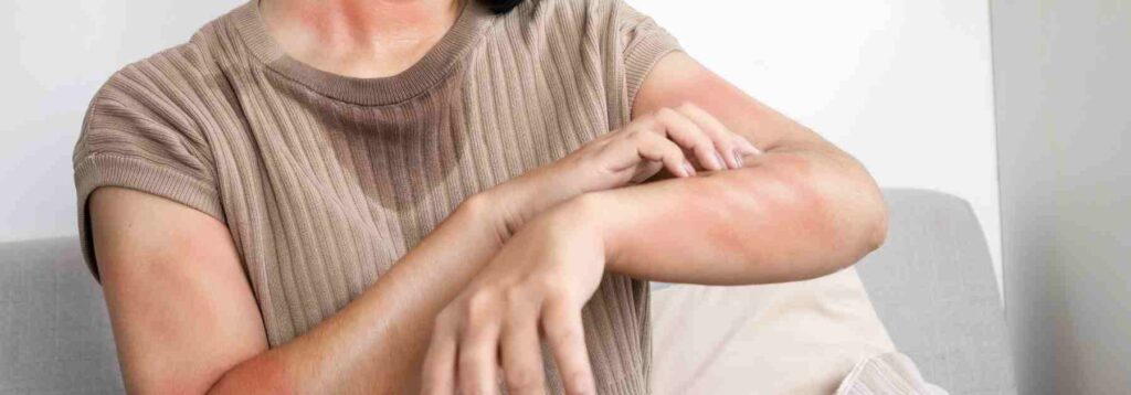 Book allergy testing in Market Harborough