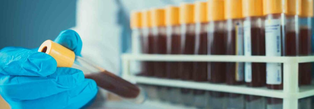 Private blood test for fatigue